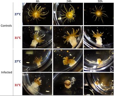 Impact of rising seawater temperature on a phagocytic cell population during V. parahaemolyticus infection in the sea anemone E. pallida